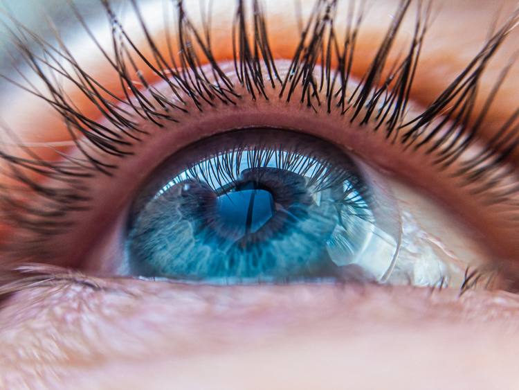 Managing dry eyes with scleral lenses in Cambridge